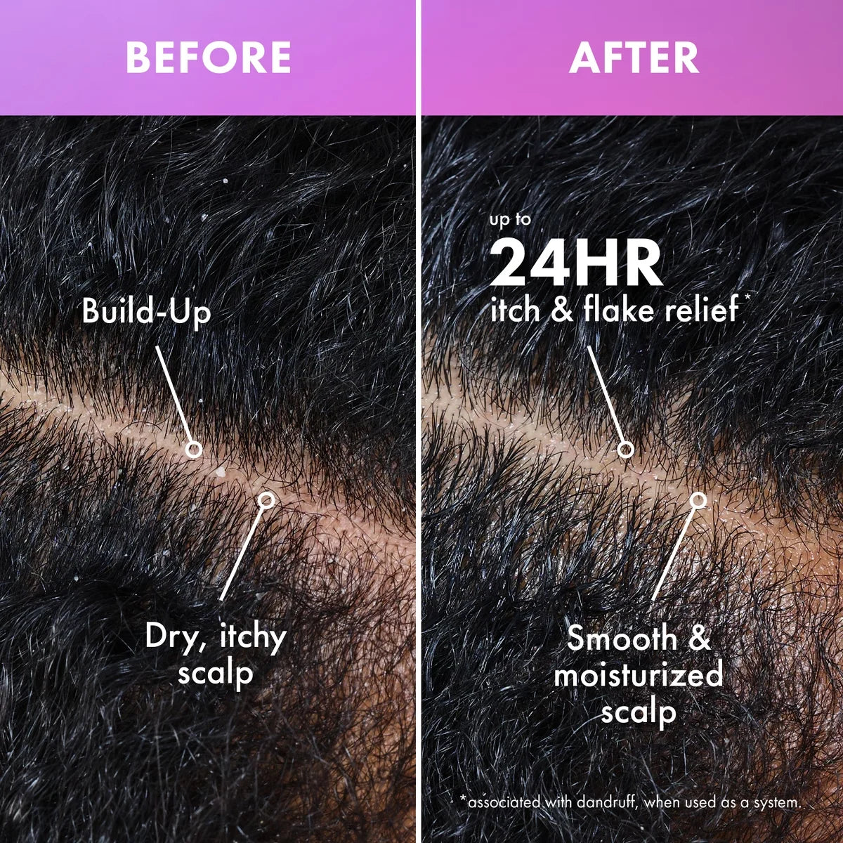Mielle Organics Scalp Soothing Shampoo - Lavender & Lychee - 12 fl oz: For Textured Hair, Liquid Formula